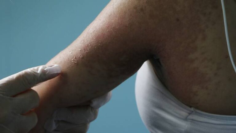 internetten krem siparis etti 4 gun yogun bakimda kaldi DcWpFZwL