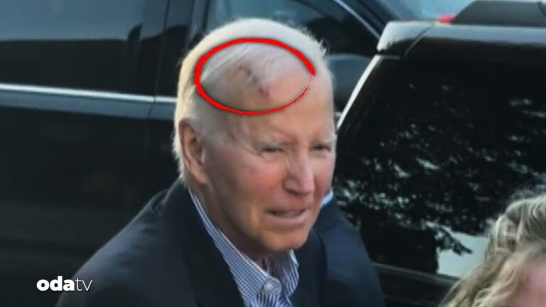 bidena kanser ameliyati uv3UOBBX