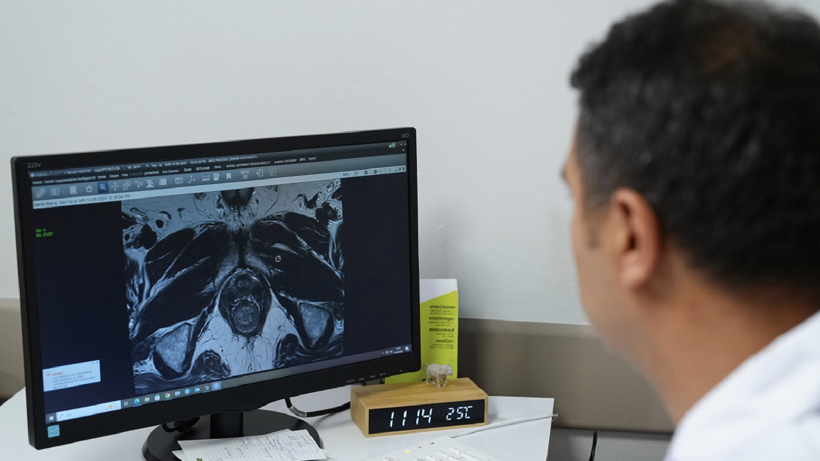 uzmanindan prostat kanserinde dogru tani uyarisi fuzyon biyopsi ile tumor odaklari hedefe yonelik sekilde tespit edilebiliyor gup4cG7J